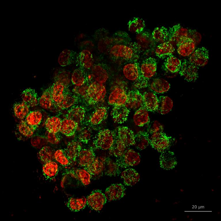 spheroid-mitochondria-nuclei-1080