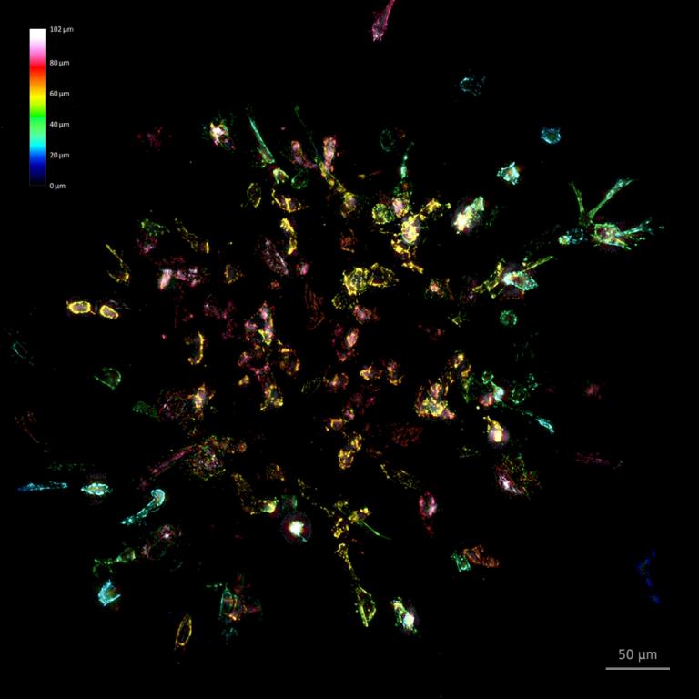 spheroid-collagen-1080