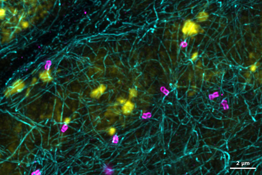 spermatogonia-drosophila-testis