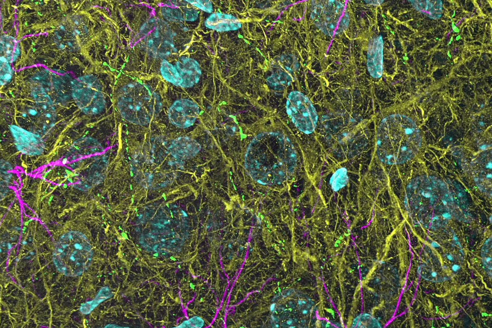 csm_3D-THUNDERed-spinning-disk-image-of-mouse-brain_14ef4e4478