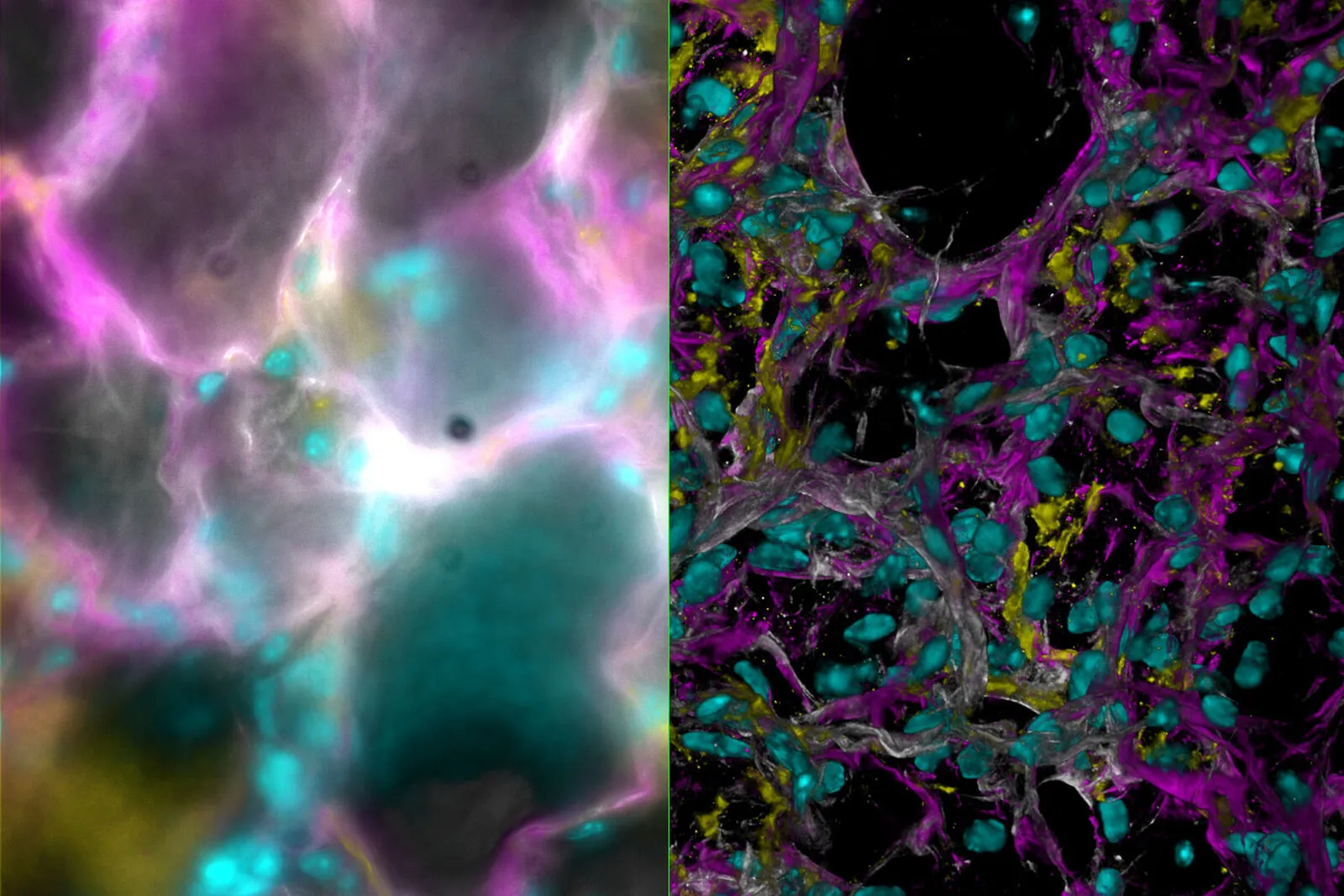 csm_Mouse-lung-tissue-stained-for-a-study-of-type-I-alveolar-epithelial-cell-AT1-biology_5e57e38456